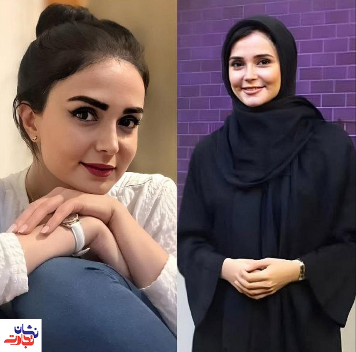 چهره کیمیا گیلانی قبل و بعد از مهاجرت